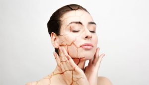 Tips Merawat kemudian juga Mengatasi Kulit Kering